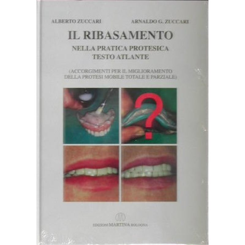 Il Ribasamento